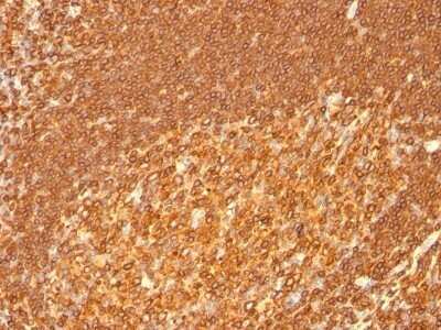 Immunohistochemistry-Paraffin: HLA DRB1 Antibody (HLA-DRB/1067) - Azide and BSA Free [NBP2-47671] - Human Tonsil stained with HLA-DRB Monoclonal Antibody (HLA-DRB/1067).