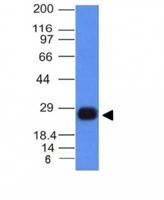 Western Blot: HLA DRB1 Antibody (HLA-DRB/1067) - Azide and BSA Free [NBP2-47671] - Anaysis of Ramos Cell Lyste using HLA-DRB Monoclonal Antibody (HLA-DRB/1067).
