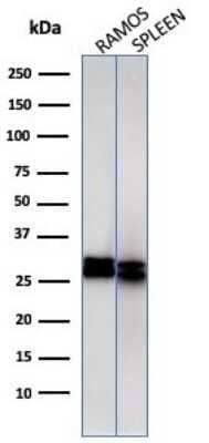 Western Blot: HLA DRB1 Antibody (HLA-DRB/1067) - Azide and BSA Free [NBP2-47671] - Western Blot Analysis of Ramos cell and human spleen tissue lysate using HLA DRB1 Antibody (HLA-DRB/1067).