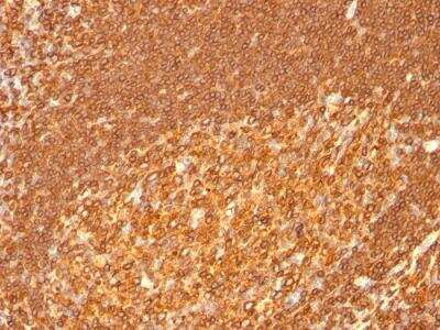 Immunohistochemistry-Paraffin: HLA DRB1 Antibody (HLA-DRB/1067) - IHC-Prediluted [NBP2-48135] - Formalin-fixed, paraffin-embedded human Tonsil stained with HLA-DR Monoclonal Antibody (HLA-DRB/1067).