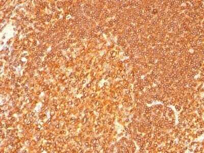 Immunohistochemistry-Paraffin: HLA DRB1 Antibody (LN-3 + HLA-DRB/1067) - Azide and BSA Free [NBP2-47672] - Human Tonsil stained with HLA-DRB Monoclonal Antibody (LN-3 + HLA-DRB/1067).