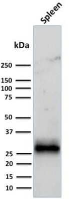 Western Blot: HLA DRB1 Antibody (LN-3 + HLA-DRB/1067) - Azide and BSA Free [NBP2-47672] - Western Blot Analysis of Human Spleen tissue lysate using HLA DRB1 Antibody (LN-3 + HLA-DRB/1067).