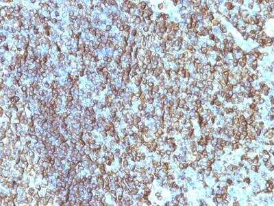 Immunohistochemistry-Paraffin: HLA DRB1 Antibody (SPM288) - IHC-Prediluted [NBP2-48122] - Human Tonsil stained with HLA-DRB Monoclonal Antibody (SPM288).