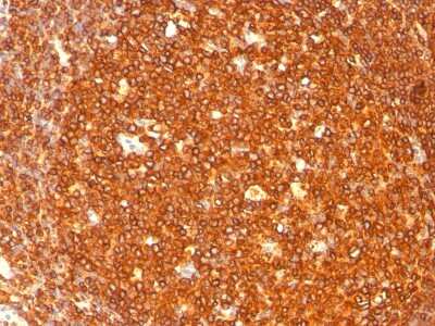 Immunohistochemistry-Paraffin: HLA DRB1 Antibody (SPM289) - Azide and BSA Free [NBP2-34756] - Formalin-paraffin human tonsil stained with HLA-DR MAb (SPM289).