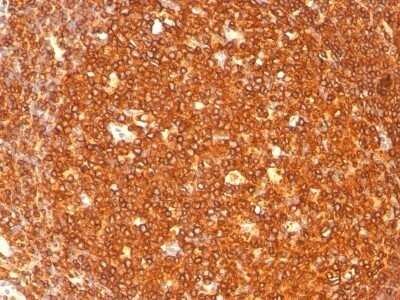 Immunohistochemistry-Paraffin: HLA DRB1 Antibody (SPM289) - IHC-Prediluted [NBP2-48113] - Human Tonsil stained with HLA-DRB Monoclonal Antibody (SPM289).