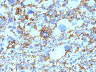 Immunohistochemistry-Paraffin: HLA DRB1 Antibody (SPM423) - IHC-Prediluted [NBP2-48123] - Human Histiocytoma stained with HLA-DR Monoclonal Antibody (SPM423).