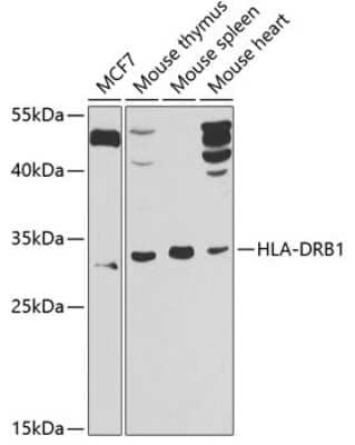 Western Blot: HLA DRB1 Antibody [NBP3-03666] - Analysis of extracts of various cell lines, using HLA DRB1 antibody at 1:1000 dilution. Secondary antibody: HRP Goat Anti-Rabbit IgG (H+L) at 1:10000 dilution. Lysates/proteins: 25ug per lane. Blocking buffer: 3% nonfat dry milk in TBST. Detection: ECL Basic Kit.