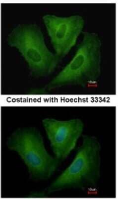 Immunocytochemistry/Immunofluorescence: HLA DRB3 Antibody [NBP1-33666] - Analysis of methanol-fixed A549, using antibody at 1:500 dilution.