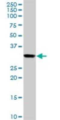 Western Blot: HLA DRB3 Antibody [H00003125-D01P] - Analysis of HLA-DRB3 expression in human kidney.