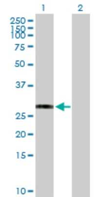 Western Blot: HLA DRB3 Antibody [H00003125-D01P] - Analysis of HLA-DRB3 expression in transfected 293T cell line by HLA-DRB3 polyclonal antibody.Lane 1: HLA-DRB3 transfected lysate(30.00 KDa).Lane 2: Non-transfected lysate.