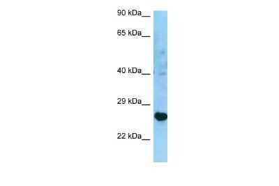 Western Blot: HLA DRB3 Antibody [NBP2-82248] - WB Suggested Anti-HLA-DRB3 Antibody. Titration: 1.0 ug/ml. Positive Control: U937 Whole Cell