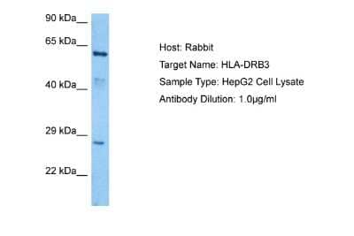 Western Blot: HLA DRB3 Antibody [NBP2-82249] - Host: Rabbit. Target Name: HLA-DRB3. Sample Tissue: HepG2 Whole Cell lysates. Antibody Dilution: 1ug/ml