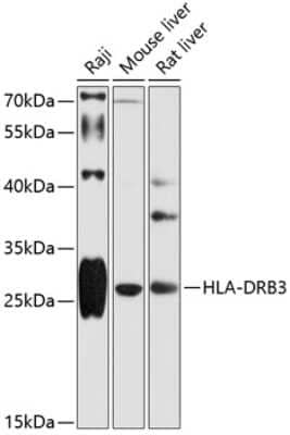 Western Blot: HLA DRB3 Antibody [NBP3-03660] - Analysis of extracts of various cell lines, using HLA DRB3 antibody at 1:1000 dilution. Secondary antibody: HRP Goat Anti-Rabbit IgG (H+L) at 1:10000 dilution. Lysates/proteins: 25ug per lane. Blocking buffer: 3% nonfat dry milk in TBST. Detection: ECL Basic Kit.