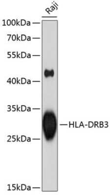 Western Blot: HLA DRB3 Antibody [NBP3-03661] - Analysis of extracts of Raji cells, using HLA DRB3 antibody at 1:1000 dilution. Secondary antibody: HRP Goat Anti-Rabbit IgG (H+L) at 1:10000 dilution. Lysates/proteins: 25ug per lane. Blocking buffer: 3% nonfat dry milk in TBST. Detection: ECL Enhanced Kit.