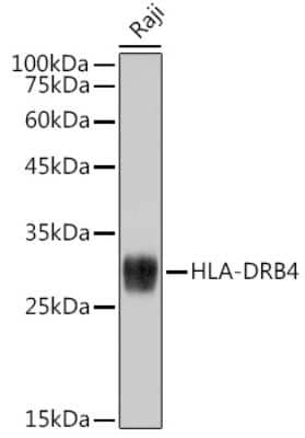 Western Blot: HLA DRB4 Antibody (3Z5V9) [NBP3-15265] - Western blot analysis of extracts of Raji cells, using HLA DRB4 antibody (NBP3-15265) at 1:1000 dilution. Secondary antibody: HRP Goat Anti-Rabbit IgG (H+L) at 1:10000 dilution. Lysates/proteins: 25ug per lane. Blocking buffer: 3% nonfat dry milk in TBST. Detection: ECL Basic Kit. Exposure time: 1s.