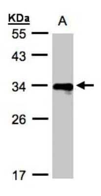 Western Blot: HLA DRB4 Antibody [NBP1-32553] - Sample(30 ug whole cell lysate)A:Raji  12% SDS PAGE, antibody diluted at 1:1000.