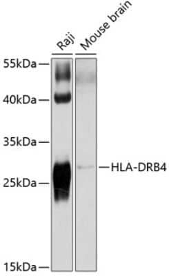 Western Blot: HLA DRB4 Antibody [NBP3-03662] - Analysis of extracts of various cell lines, using HLA DRB4 antibody at 1:1000 dilution. Secondary antibody: HRP Goat Anti-Rabbit IgG (H+L) at 1:10000 dilution. Lysates/proteins: 25ug per lane. Blocking buffer: 3% nonfat dry milk in TBST. Detection: ECL Basic Kit.