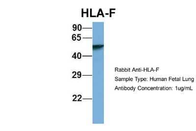Western Blot: HLA F Antibody [NBP1-59524] - Human Fetal Lung, Antibody Dilution: 1.0 ug/ml.