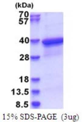 SDS-PAGE Recombinant Human HLA F His Protein