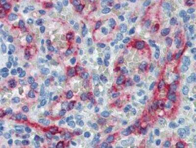 Immunohistochemistry-Paraffin: HLA G Antibody (4H84) [NB110-55297] - Staining of human spleen (paraffin sections) using anti-HLA-G (4H84).