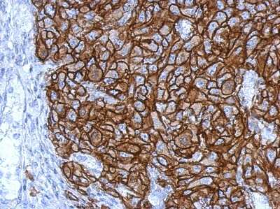 Immunohistochemistry-Paraffin: HLA G Antibody [NBP2-16855] - Mahlarvu xenograft, using HLA-G antibody at 1:500 dilution. Antigen Retrieval: TrilogyTM (EDTA based) buffer, 15min