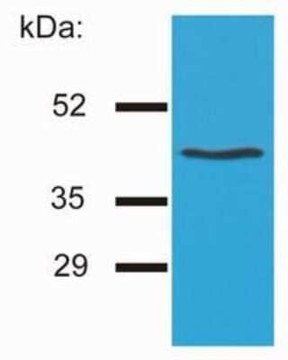 Western Blot: HLA G Antibody (MEM-G/4) [NB500-533] - Analysis of HLA-G by the antibody MEM-G/4 on HLA-G1 transfectants (LCL-HLA-G1).