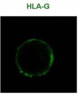 Immunocytochemistry/Immunofluorescence: HLA G Antibody (MEM-G/9) [Alexa Fluor® 488] [NB500-314AF488] - Staining of HLA-G1 transfectants (LCL-HLA-G1) using Alexa Fluor 488 conjugated anti-human HLA-G (MEM-G/9).