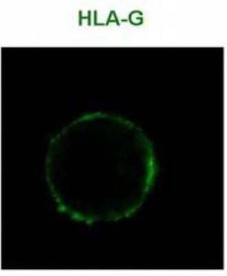 Immunocytochemistry/Immunofluorescence: HLA G Antibody (MEM-G/9) [NB500-314] - Staining of HLA-G1 transfectants (LCL-HLA-G1) using Alexa Fluor 488 conjugated anti-human HLA-G (MEM-G/9).