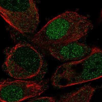 Immunocytochemistry/Immunofluorescence: HLF Antibody [NBP2-56606] - Staining of human cell line PC-3 shows localization to nucleus. Antibody staining is shown in green.