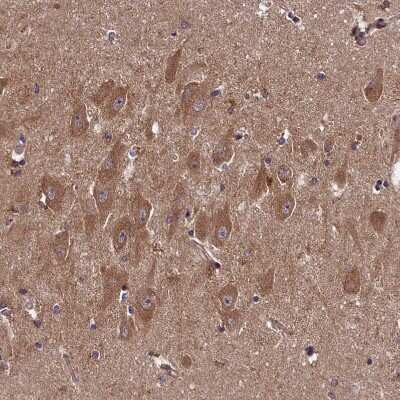 Immunohistochemistry-Paraffin: HLRC1 Antibody [NBP1-91994] - Staining of human hippocampus shows strong cytoplasmic positivity in neurons.