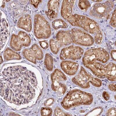 Immunohistochemistry-Paraffin: HLRC1 Antibody [NBP1-91994] - Staining of human kidney shows moderate cytoplasmic positivity in cells in tubules.