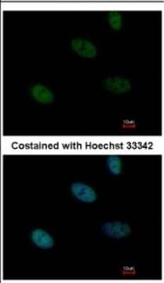 Immunocytochemistry/Immunofluorescence: HLTF Antibody [NBP2-16857] - Immunofluorescence analysis of paraformaldehyde-fixed HeLa, using antibody at 1:500 dilution.