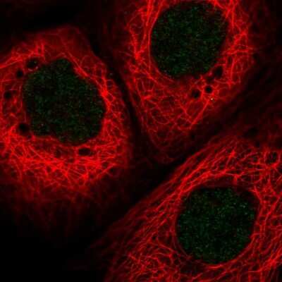Immunocytochemistry/Immunofluorescence: HLTF Antibody [NBP2-55017] - Staining of human cell line A-431 shows localization to nucleus.