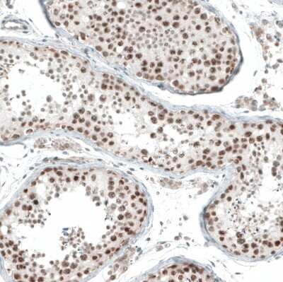 Immunohistochemistry-Paraffin: HLTF Antibody [NBP1-83256] - Staining of human testis shows moderate to strong nuclear positivity in cells in seminiferous ducts.