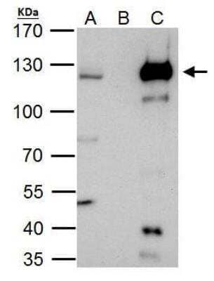Immunoprecipitation: HLTF Antibody [NBP2-16857] - HLTF antibody immunoprecipitates HLTF protein in IP experiments. IP Sample: HeLa whole cell lysate/extract. A. 40 ug HeLa whole cell lysate/extract. B. Control with 2 ug of preimmune rabbit IgG. C. Immunoprecipitation of HLTF protein by 2 ug of HLTF antibody. 7.5% SDS-PAGE. The immunoprecipitated HLTF protein was detected by HLTF antibody diluted at 1:1000. 