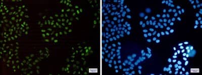 Immunocytochemistry/Immunofluorescence: HLTF Antibody (S03-1E4) [NBP3-19653] - Immunofluorescence of HLTF (green) in Hela cells using NBP3-19653 at dilution 1/50, and DAPI (blue)