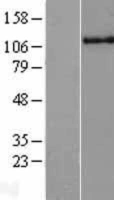 Western Blot: HLTF Overexpression Lysate (Adult Normal) [NBL1-11599] Left-Empty vector transfected control cell lysate (HEK293 cell lysate); Right -Over-expression Lysate for HLTF.