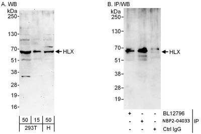 Immunoprecipitation: HLX1 Antibody [NBP2-04033] - Samples: Whole cell lysate from 293T (15 and 50 ug for WB; 1 mg for IP, 20% of IP loaded) and HeLa (H; 50 ug) cells. Antibodies: Affinity purified rabbit anti-HLX antibody used for WB at 0.1 ug/ml (A) and 1 ug/ml (B) and used for IP at 6 ug/mg lysate. HLX was also immunoprecipitated by rabbit anti-HLX antibody BL12796, which recognizes an upstream epitope. Detection: Chemiluminescence with exposure times of 3 minutes (A) and 30 seconds (B).