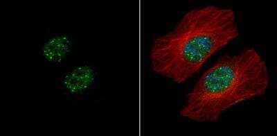 Immunocytochemistry/ Immunofluorescence HMBOX1 Antibody - BSA Free