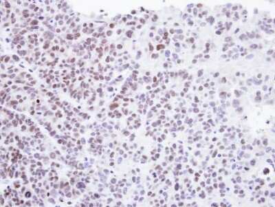 Immunohistochemistry-Paraffin HMBOX1 Antibody - BSA Free
