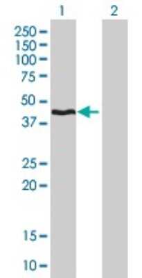 Western Blot: HMBS Antibody (3E8) [H00003145-M01] - Analysis of HMBS expression in transfected 293T cell line by HMBS monoclonal antibody (M01), clone 3E8.Lane 1: HMBS transfected lysate(39.71 KDa).Lane 2: Non-transfected lysate.