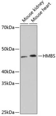 Western Blot: HMBS Antibody (9T8Z9) [NBP3-15407] - Western blot analysis of extracts of various cell lines, using HMBS Rabbit mAb (NBP3-15407) at 1:1000 dilution. Secondary antibody: HRP Goat Anti-Rabbit IgG (H+L) at 1:10000 dilution. Lysates/proteins: 25ug per lane. Blocking buffer: 3% nonfat dry milk in TBST. Detection: ECL Basic Kit. Exposure time: 3min.