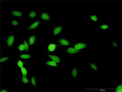 Immunocytochemistry/Immunofluorescence: HMBS Antibody [H00003145-D01P] - Analysis of antibody to HMBS on HeLa cell. Antibody concentration 10 ug/ml.