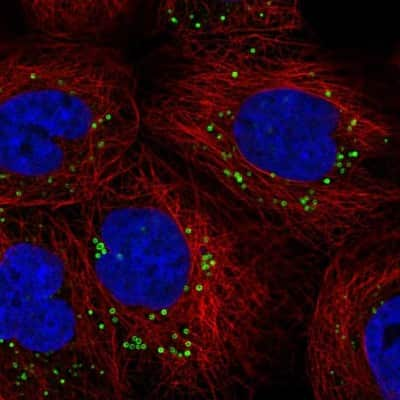 Immunocytochemistry/Immunofluorescence: HMBS Antibody [NBP2-33600] - Staining of human cell line A-431 shows localization to lipid droplets.