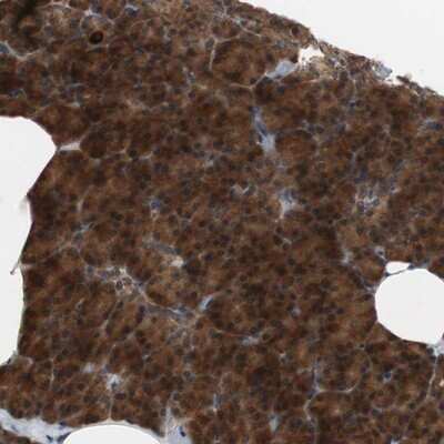 Immunohistochemistry-Paraffin: HMBS Antibody [NBP1-87329] - Staining of human pancreas shows strong cytoplasmic positivity in exocrine glandular cells.