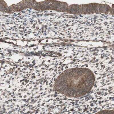 Immunohistochemistry-Paraffin: HMBS Antibody [NBP1-87329] - Staining of human endometrium shows moderate to strong cytoplasmic positivity in glandular cells.