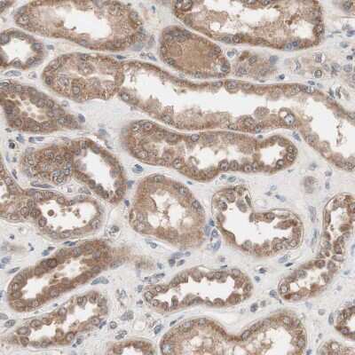 Immunohistochemistry-Paraffin: HMBS Antibody [NBP1-87329] - Staining of human kidney shows moderate cytoplasmic positivity in cells in tubules.