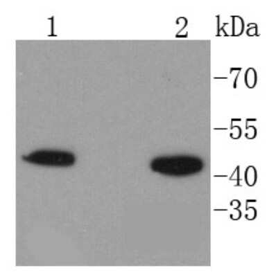 Western Blot: HMBS Antibody (SC65-07) [NBP2-67637] - Analysis of HMBS on different lysates using anti-HMBS antibody at 1/1,000 dilution. Positive control: Lane 1: Hela Lane 2: 293T
