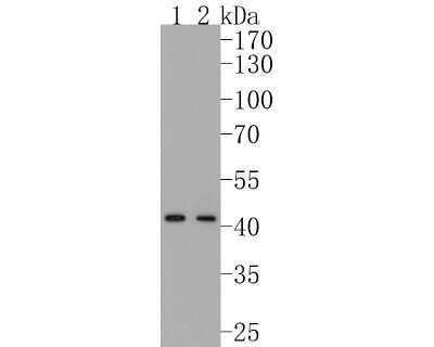 Western Blot: HMBS Antibody (SC65-07) [NBP2-67637] - Analysis of HMBS on different lysates. Proteins were transferred to a PVDF membrane and blocked with 5% BSA in PBS for 1 hour at room temperature. The primary antibody (1/500) was used in 5% BSA at room temperature for 2 hours. Goat Anti-Rabbit IgG - HRP Secondary Antibody at 1:200,000 dilution was used for 1 hour at room temperature. Positive control: Lane 1: Hela cell lysate Lane 2: 293T cell lysate