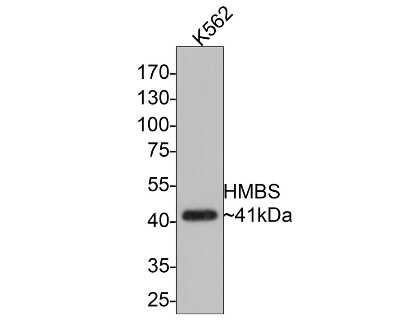 Western Blot: HMBS Antibody (SC65-07) [NBP2-67637] - Analysis of HMBS on K562 cell lysates with Rabbit anti-HMBS antibody at 1/500 dilution. Lysates/proteins at 10 ug/Lane. Predicted band size: 39 kDa Observed band size: 41 kDa Exposure time: 30 seconds; 10% SDS-PAGE gel. Proteins were transferred to a PVDF membrane and blocked with 5% NFDM/TBST for 1 hour at room temperature. The primary antibody at 1/500 dilution was used in 5% NFDM/TBST at room temperature for 2 hours. Goat Anti-Rabbit IgG - HRP Secondary Antibody at 1:200,000 dilution was used for 1 hour at room temperature.